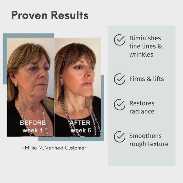 Suero antienvejecimiento REN™ Advanced Collagen Boost ⭐⭐⭐⭐⭐